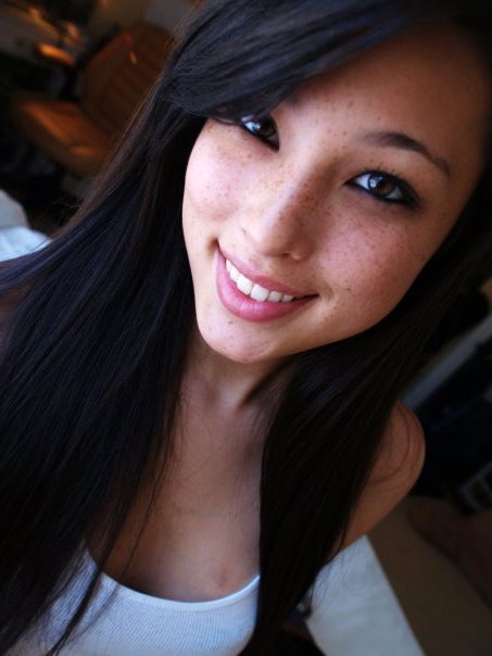 Asian freckles