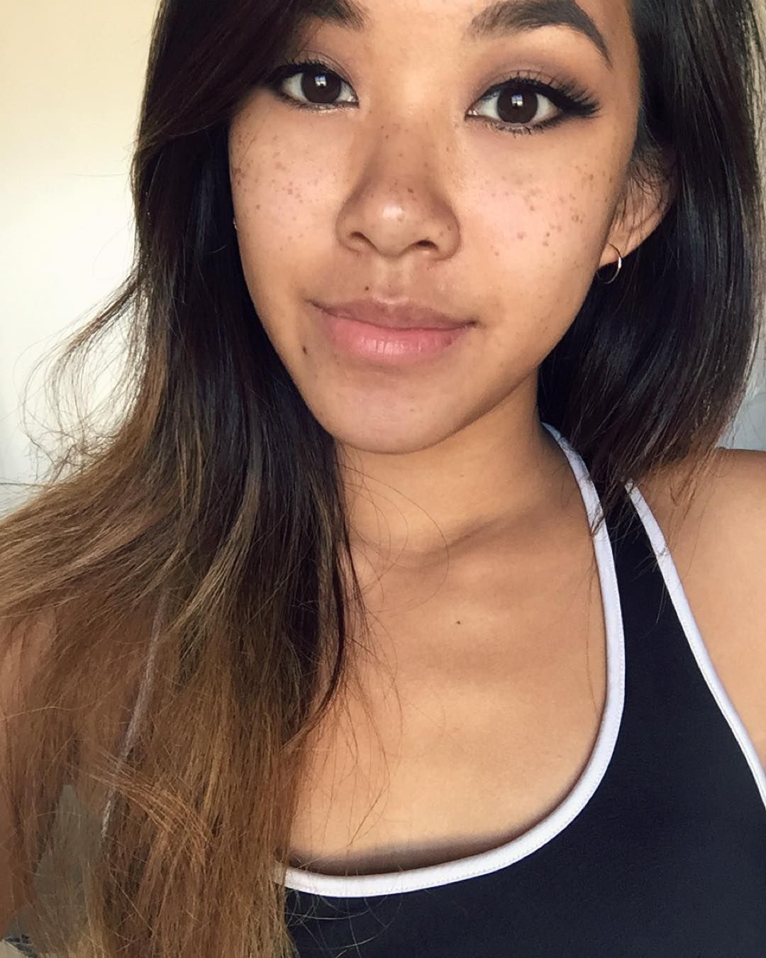 Asian freckles